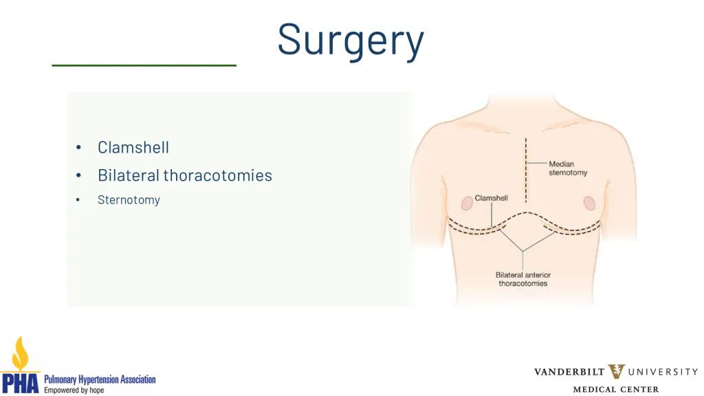 Lung transplantation webinar