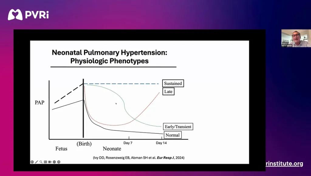 Screenshot of webinar